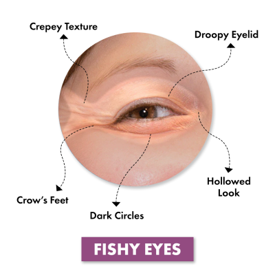 Fishy eyes