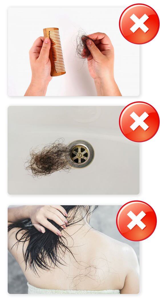 Excessive Hairfall images