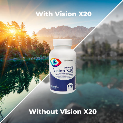 vision x20
