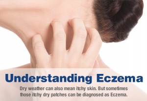 Woman With Eczema