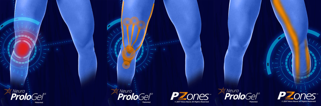 Knee ProloGel