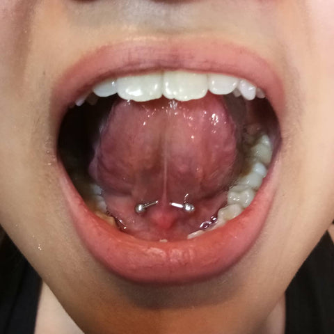 Tongue Frenulum Piercing