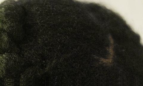 Afrocenchix, what is dandruff? Close up of braided afro hair