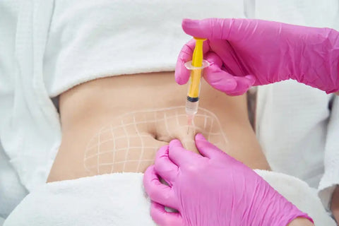 What are Lipodissolve Injections?