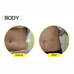 Lemonbottle before and after body