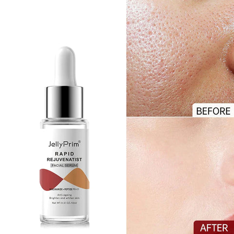 Niacinamide Serum Dark Spot Remover