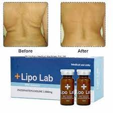 Lipo Lab before and after