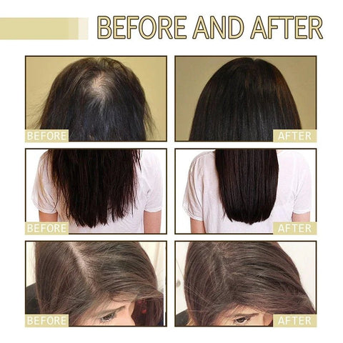 EELHOE hair growth oil before and after