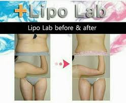 lipo lab injection for arms