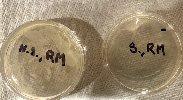 Cells grew on the non-selective plate (left) but not on the selective one (right).