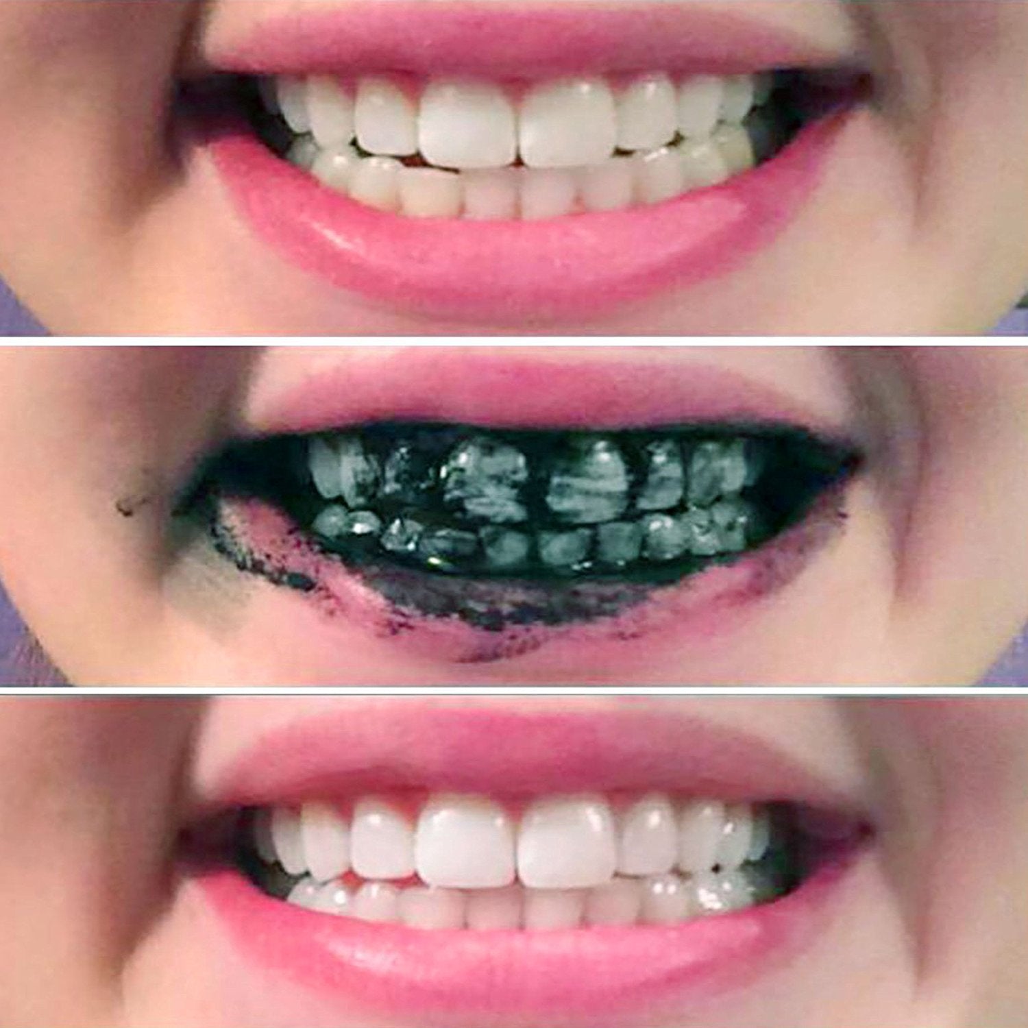 Teeth Whitening App Mac