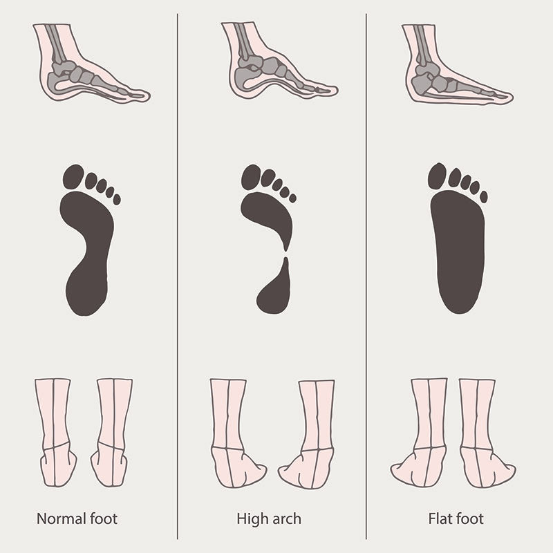 flat foot test