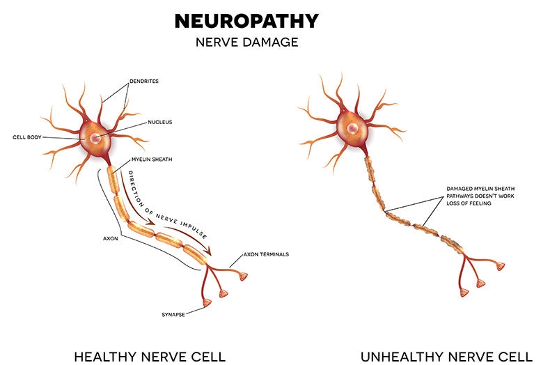 Nerve Diagram