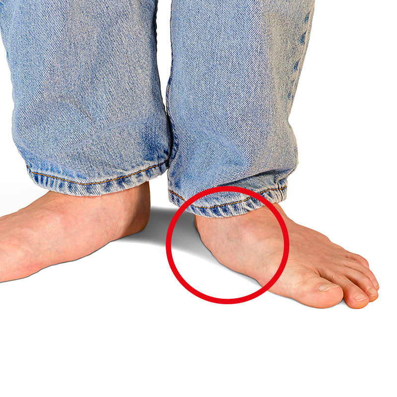 Arch Support Inserts | Orthotic Arch 