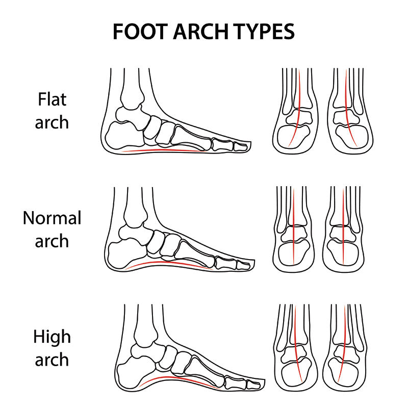 proper arch support