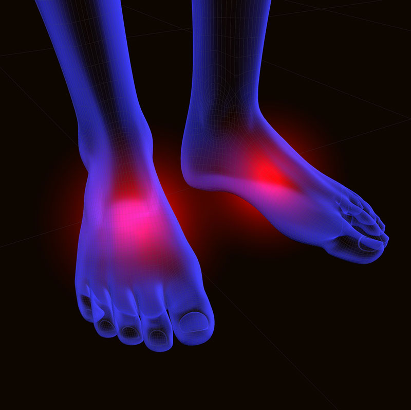 best insoles for neuropathy