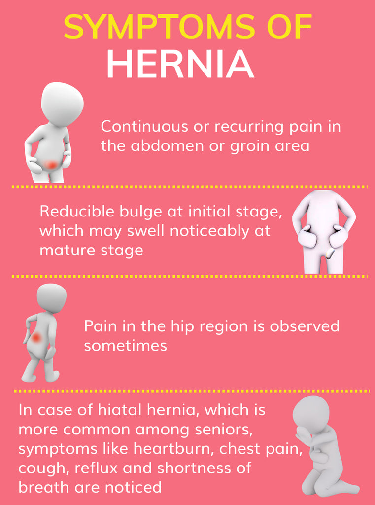 Infographic on signs and symptoms of hernia
