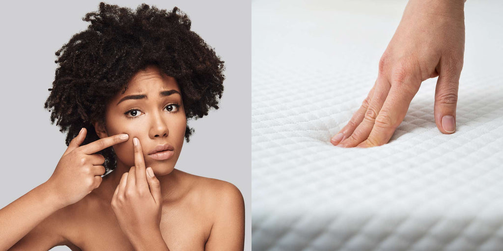 Can Your Mattress Cause Acne Breakouts?