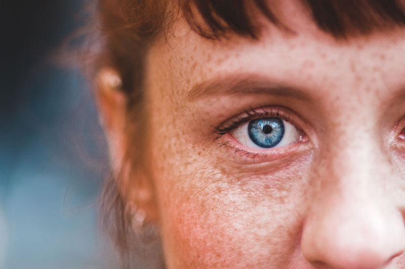 Close-up on young woman face with freckles