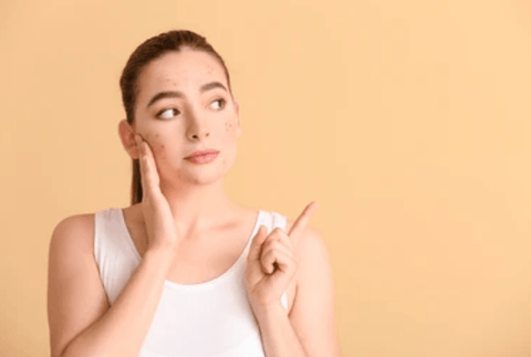 Women showing her pigmentation and against a light orange background.