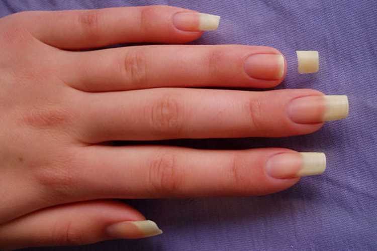 Signs That Tell You To Chop Your Nails Short!