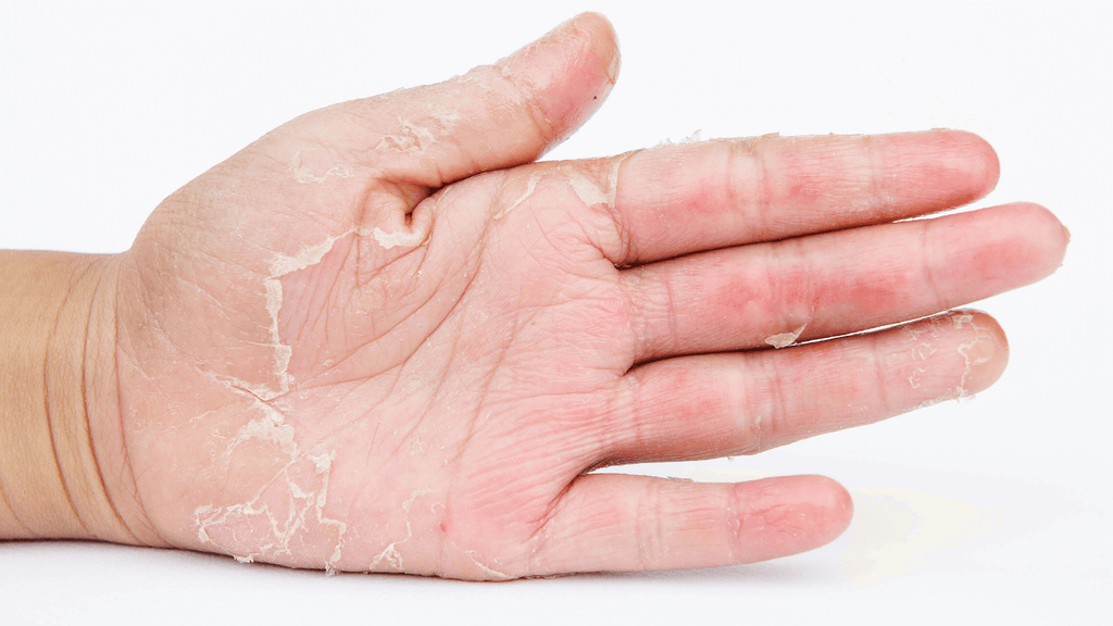 Basic Hand Care Regimen That You Must Follow!