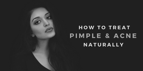 Treat Pimples and Acne Naturally