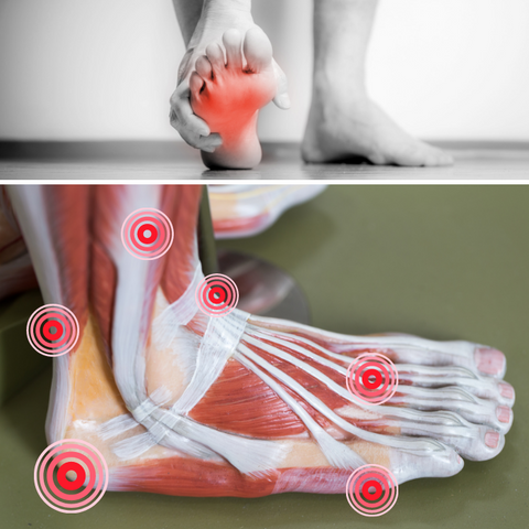 What is Myofascial Dysfunction foot pain