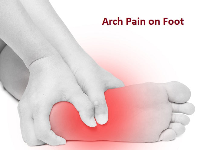 top arch pain in foot