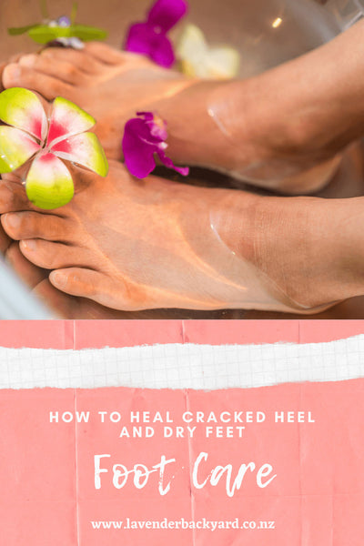 How to Heal Cracked Heel and Dry Feet? | NZ Lavender Farm – Lavender  Backyard Garden®