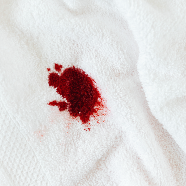 period blood on white towel