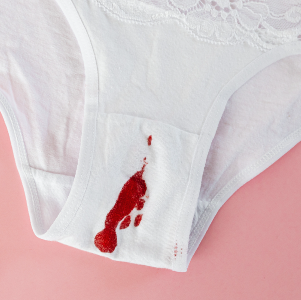 free bleeding on white pants