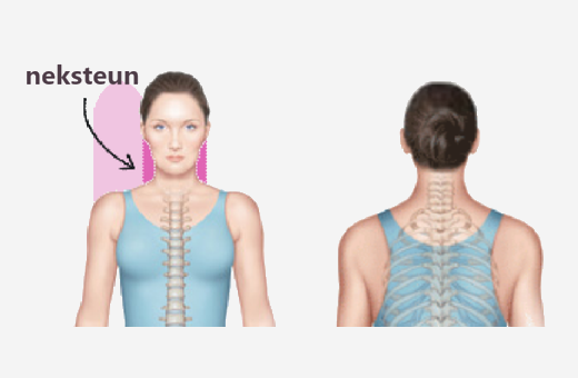 neksteun bij orthopedisch kussen