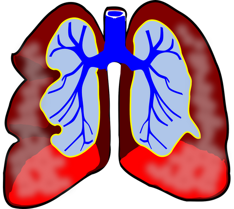 Illustration of lungs and bronchial tubes.