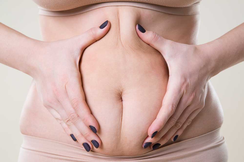 5 Most Recommended Ways to Reduce Tummy after Pregnancy – Gabrialla