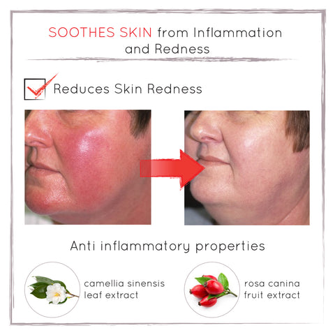 Before and After - Reduced Redness