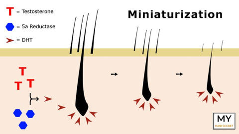 DHT Menopause hormones hair loss