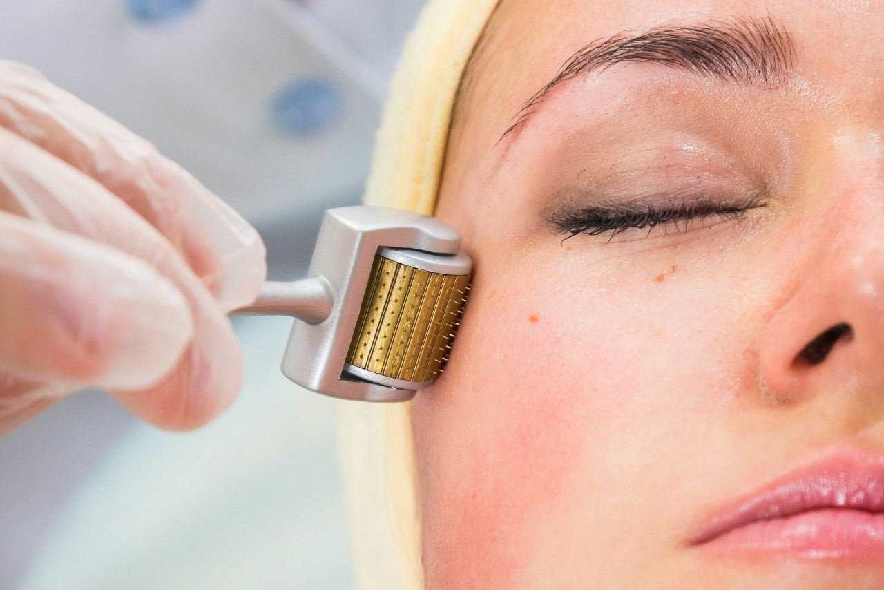 Dermarolling (or Microneedling!): The Pros & Cons – CEL MD
