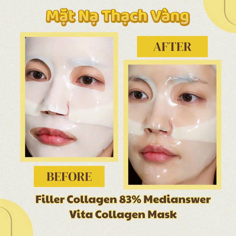 MediAnswer Vita Collagen Mask - Mặt Nạ Thạch Vàng Filler Collagen 83% –  7Blush