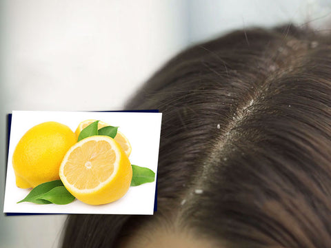 Lemon Benefits for Dandruff