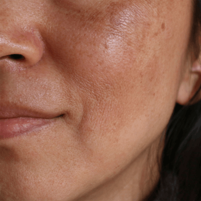 how to shrink pores