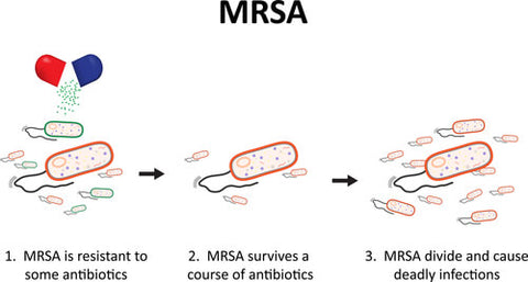 MRSA Methicillin-resistant Staphylococcus aureus