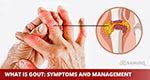 What is gout? Symptoms and management