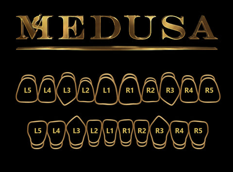 Custom Medusa Grillz in Yellow Gold Custom Jewelry