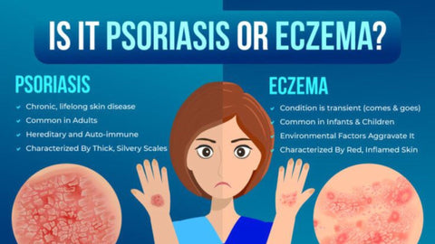 Is it psoriasis or eczema?