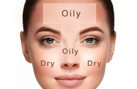 Combination skin is often experienced as — you guessed it — a combination of having both dry and oily skin. With this skin type, dryness is commonly experienced on the cheeks, while the T-Zone tends to remain oily. 