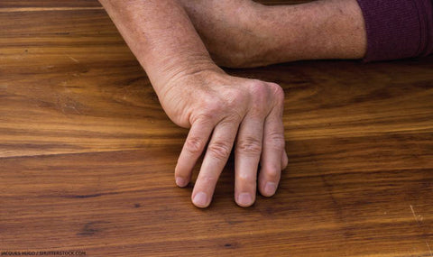 Psoriatic Arthritis: While not a type of psoriasis that affects the skin, psoriatic arthritis is a related condition that involves joint inflammation along with skin symptoms. It can cause joint pain, swelling, and stiffness in addition to psoriasis symptoms.