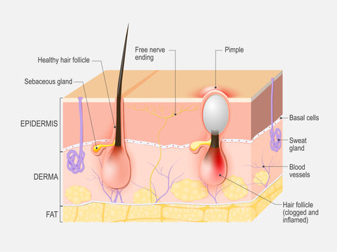 Anatomy of skin, glands, and clogged pores