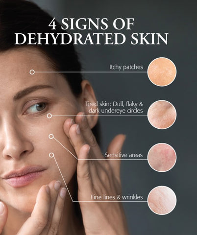 four signs of dehydrated skin and skincare tips on how to maintain healthy, glowing skin during the hot summer weather