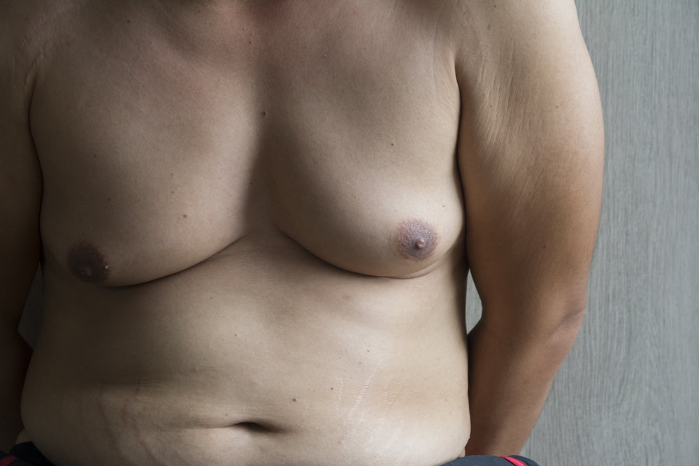 Man Boobs – Image from Shutterstock